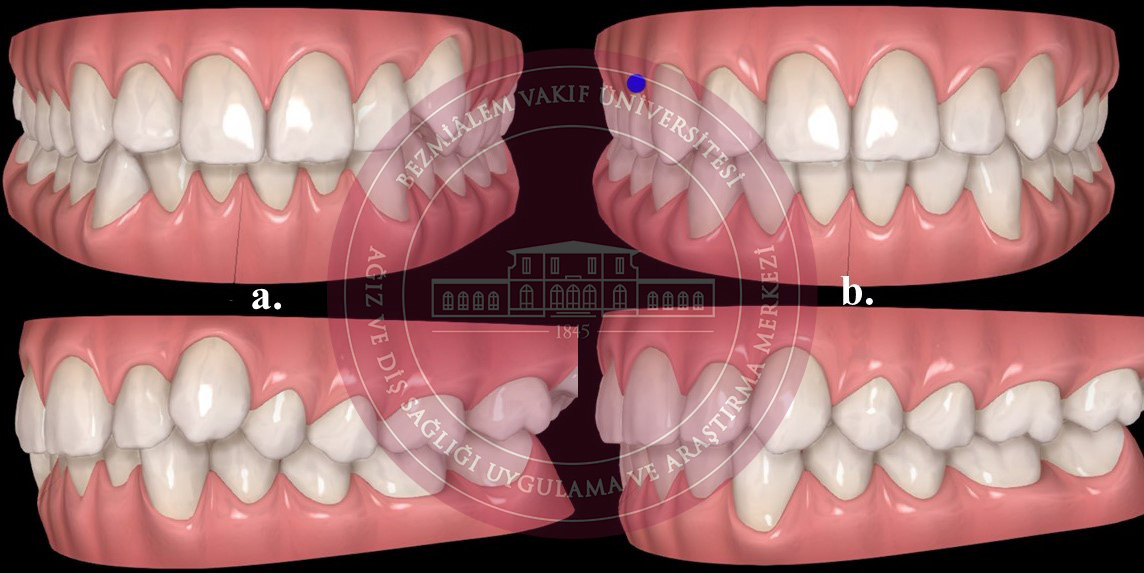 Resim 2 ortodonti.jpg