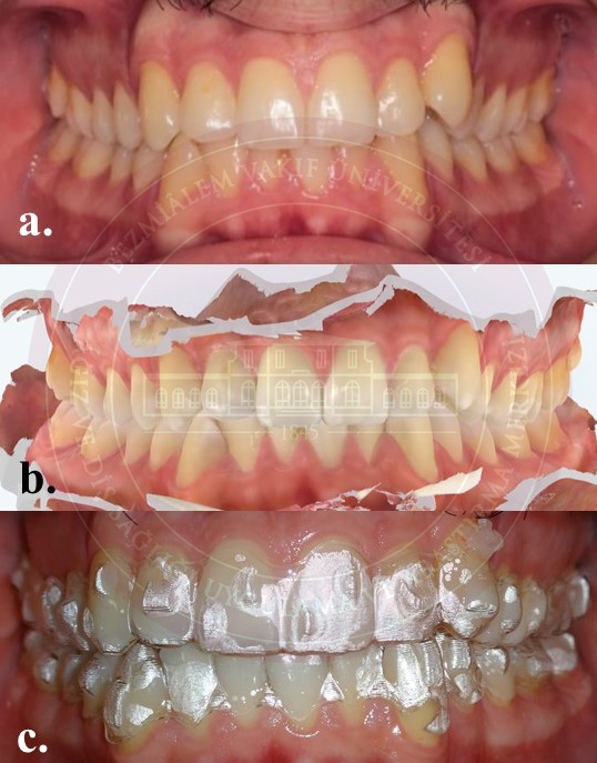 Resim 3 ortodonti.jpg